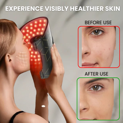 Glowifect™ Radiant Skin LED Therapy Mask